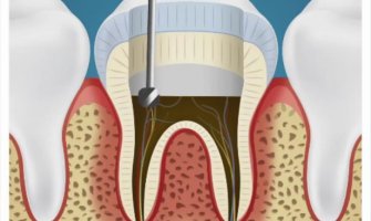  Evo šta zubar radi dok vam popravlja zube (VIDEO)