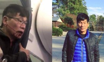 Putniku izbačenom iz aviona polomljeni zubi i nos, zadobio potres mozga