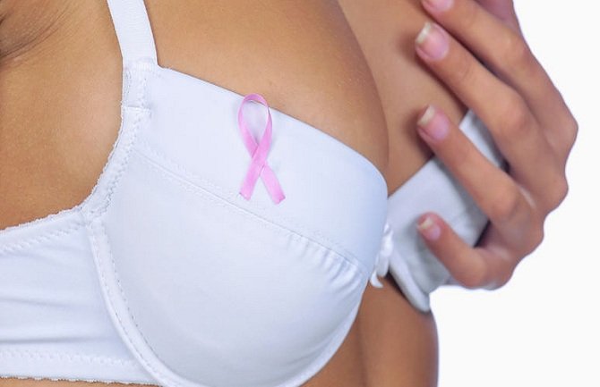 Rak dojke može da se vrati i 15 godina nakon uspješnog liječenja