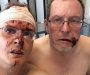 Hrvatica i njen muž metalnom šipkom brutalno pretukli gej par (FOTO)