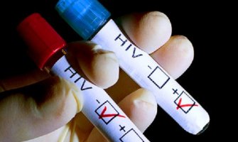 Naučnici otkrili način da mjesecima suzbijaju HIV virus u tijelu pacijenta