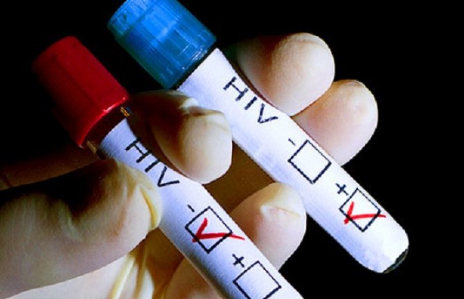 UN: Oko 9,4 miliona osoba u svijetu ne znaju da su zaraženi HIV-om
