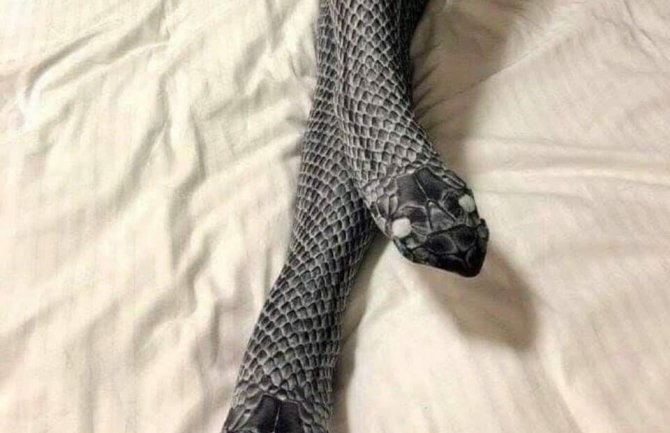 Kupila seksi čarape da obraduje muža, sada se oporavlja u bolnici (FOTO)