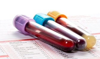 Novi test krvi može da detektuje rak dojke