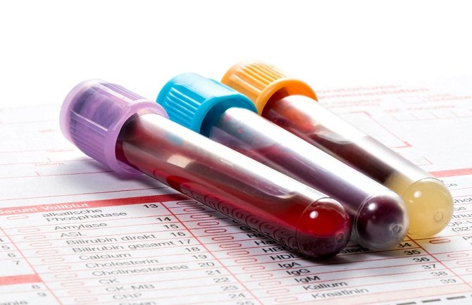 Novi test krvi može da detektuje rak dojke