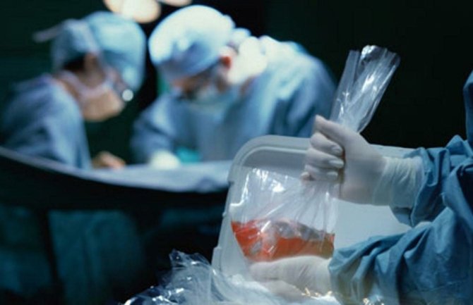 Uređeno doniranje organa od umrlog lica 