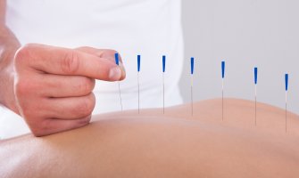 Akupunkturista slučajno probio plućno krilo pacijentkinje