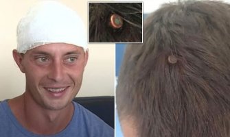 Konstantin pukom srećom preživio metak u glavu(VIDEO)