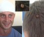 Konstantin pukom srećom preživio metak u glavu(VIDEO)