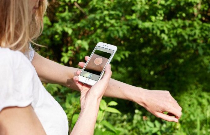 Mobilna aplikacija koja može da prepozna rak kože