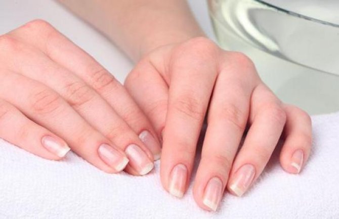 Boja i pruge na noktima mogu unaprijed da upozore na rizik od bolesti