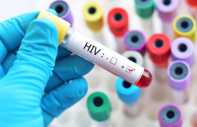 Besplatno testiranje na HIV/AIDS 7.decembra