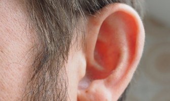 Dlake na ušima su prvi znak opasne bolesti