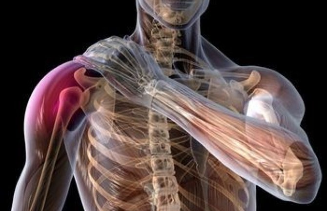 Bol u ramenu: Uzroci i posljedice po zdravlje 