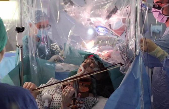 Ženi operisali tumor na mozgu, ona za vrijeme operacije svirala violinu (VIDEO)