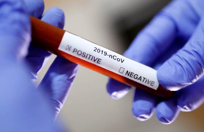 U Hrvatskoj porastao broj zaraženih za 80, ukupan broj oboljelih od koronavirusa 206