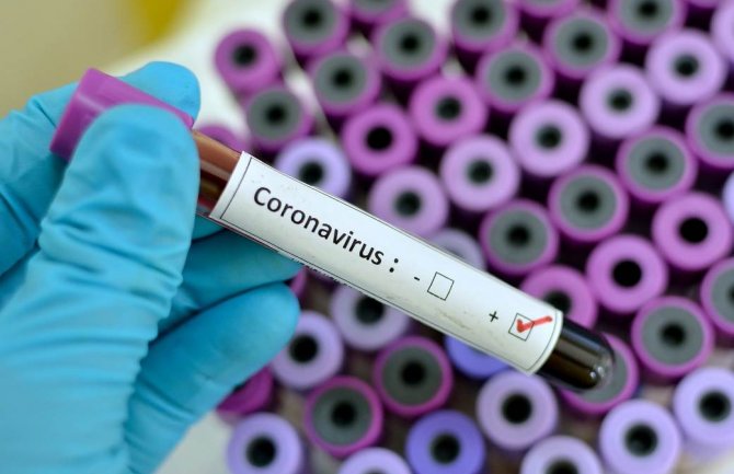 Koronavirus stigao u BiH i Sloveniju