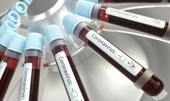 Kineski doktori otkrili koja je krvna grupa najpodložnija napadu koronavirusa