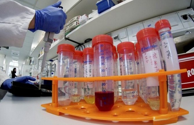 U Srbiji osam novih slučajeva koronavirusa,  ukupno 97 