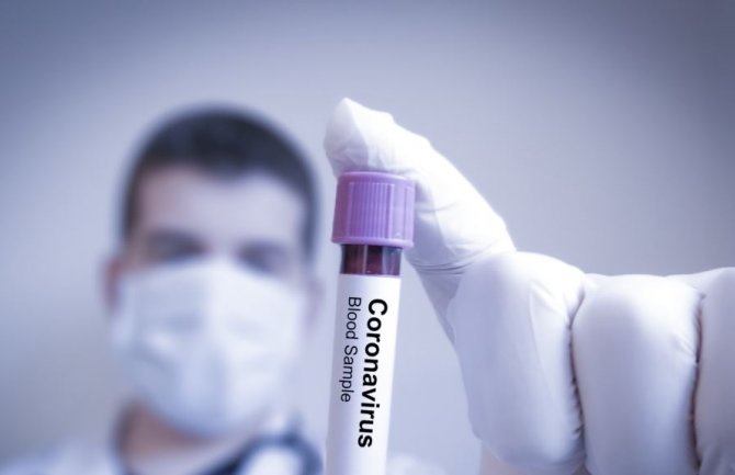 Novih 16 slučajeva koronavirusa u Republici Srpskoj