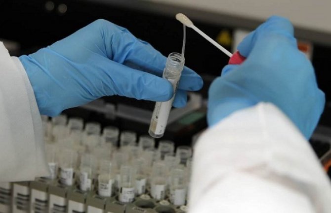 BiH: Potvrđeno 14 novih slučajeva  koronavirusa, ukupan broj 150