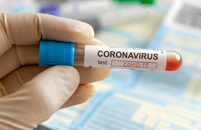 U Crnoj Gori još dvoje zaraženo koronavirusom, ukupno 69