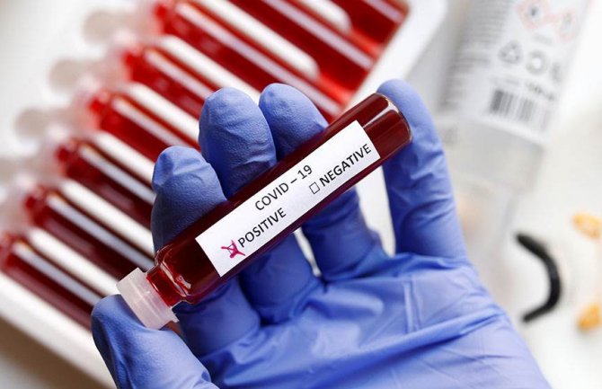 Njemačka će na koronavirus testirati pola miliona ljudi nedjeljno