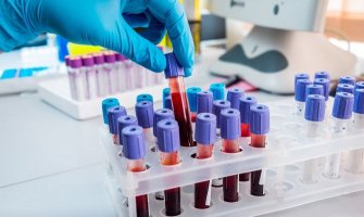 Luksemburg dobija krvne testove za koronavirus, otkrivaće ko je imun, zaražen i ko nije 