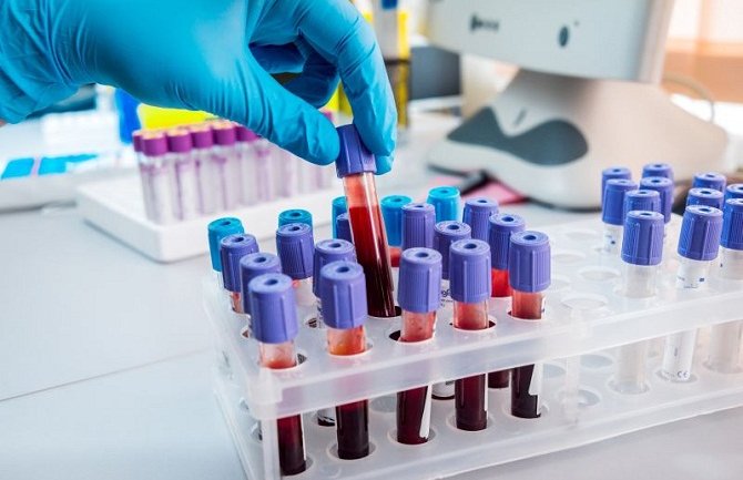 Luksemburg dobija krvne testove za koronavirus, otkrivaće ko je imun, zaražen i ko nije 