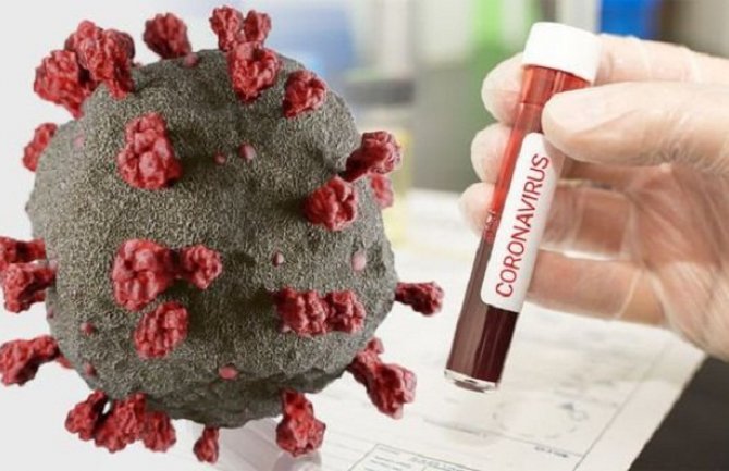 Prvi smrtni slučaj koronavirusa u RS