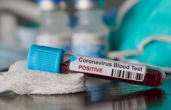 Šest novih slučajeva koronavirusa u CG, Lazović: Nema priključenih na respiratore