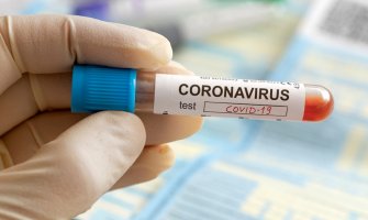 Rusija dnevno testira između 34.000 i 37.000 ljudi na virus Covid-19