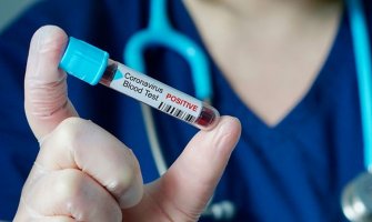 Prethodni dan najteži za Sj. Makedoniju: Preminulo pet osoba od koronavirusa