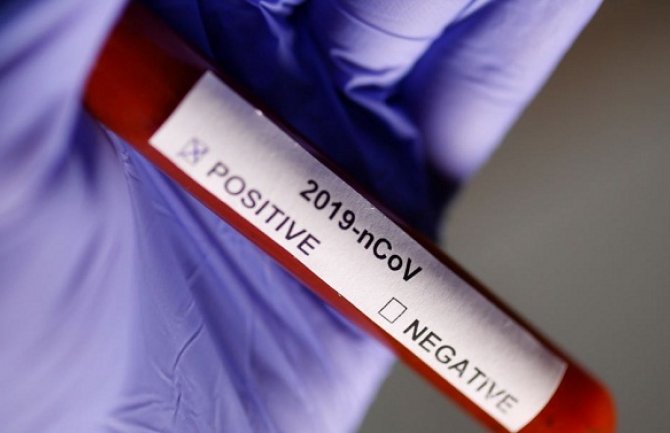 Hrvatska: 61 novi slučaj koronavirusa, jedan pacijent preminuo