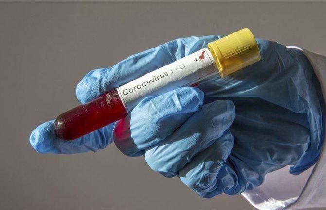 U Sloveniji od koronavirusa preminule još tri osobe
