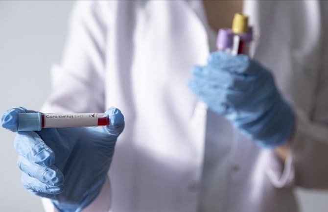 U Rusiji zabilježeno 1.459 novozaraženih koronavirusom, 76 oboljelih umrlo