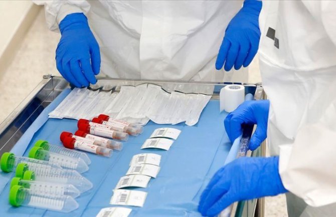 Sjeverna Makedonija:  Umrlo još šest ljudi zaraženih koronavirusom