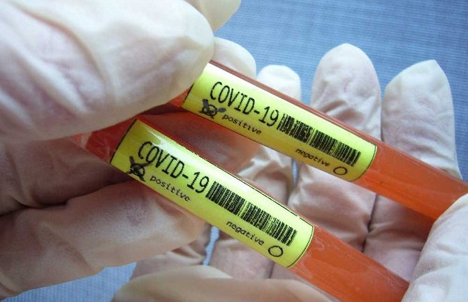 U Holandiji zaraženo koronavirusom više od 37 hiljada osoba