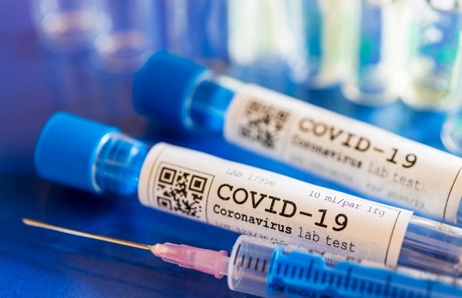 Francuska: Muškarac bio pozitivan na koronavirus 27. decembra