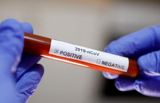 U Hrvatskoj u poslednja 24 sata zabilježeno 15 novih slučajeva koronavirusa
