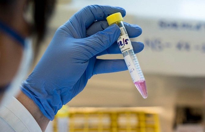 Još 41 osoba zaražena koronavirusom u BiH, Slovenija bez novozaraženih