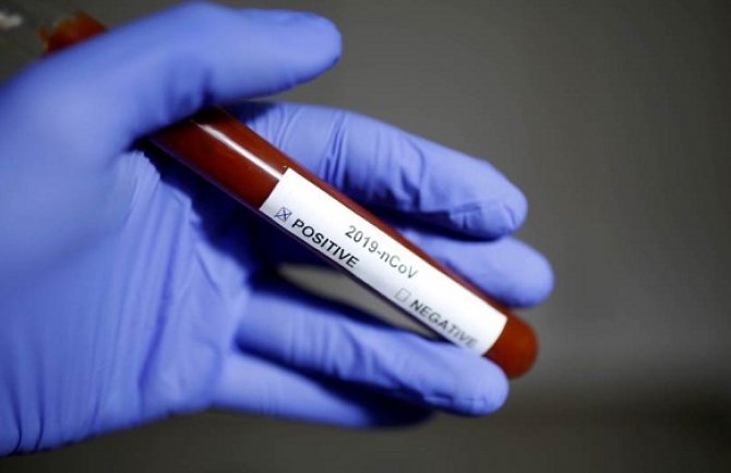Još jedan crni dan za Ameriku: Više od 50 hiljada oboljelih od koronavirusa u jednom danu