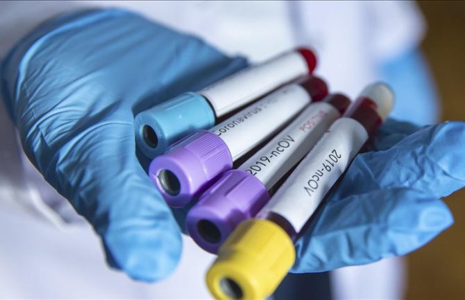U posljednja 24 časa u Srbiji rekordan broj zaraženih od koronavirusa: Prijavljeno 227 slučajeva zaraze