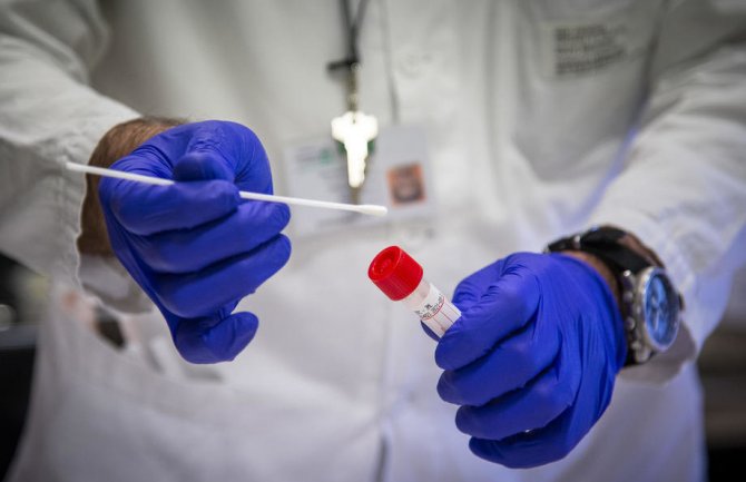 U posljednja 24 časa u Hrvatskoj još 69 slučajeva zaraze koronavirusom, pet pacijenata na respiratoru