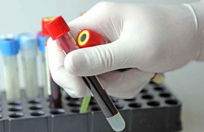 Još 3 slučaja koronavirusa, novooboljeli  iz Podgorice, Danilovgrada i Budve