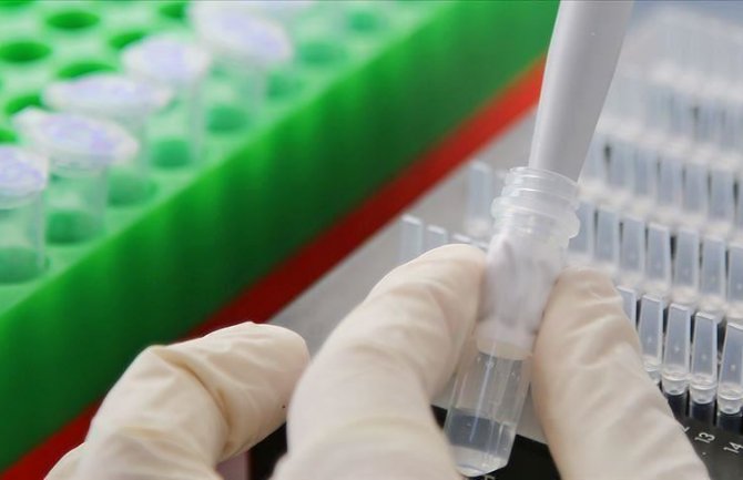 193 nova slučaja koronavirusa u Srbiji, jedna osoba preminula