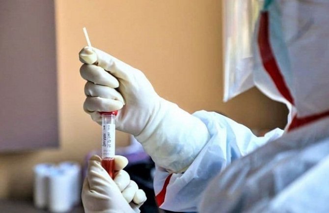 BIH:  U poslednja 24h preminulo devet osoba od posljedica koronavirusa