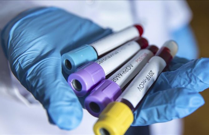 U Grčkoj potvrđeno 20 novih slučajeva koronavirusa
