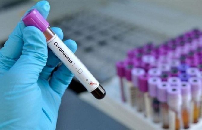 U Sjevernoj Makedoniji 120 novih slučajeva koronavirusa, na respiratoru deset pacijenata