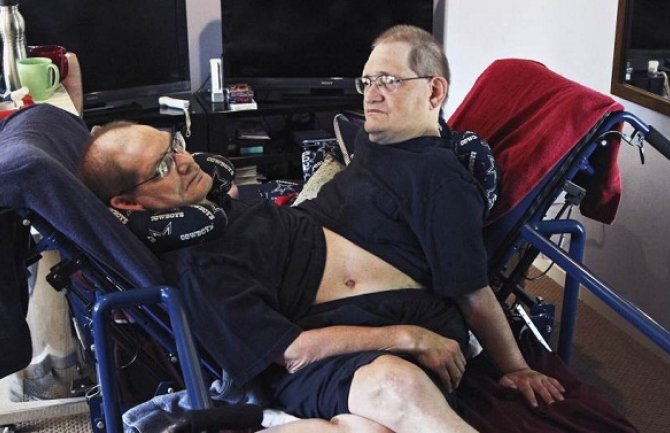 Preminuli sijamski blizanci s najdužim životnim vijekom